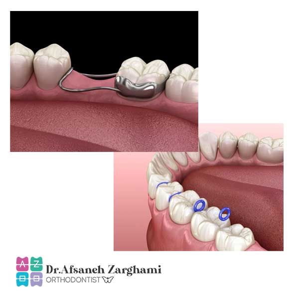 فضانگهدارنده دندان در تبریز